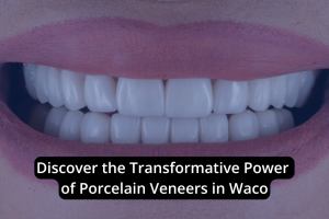 Close-up of a person's mouth showing straight, white teeth with porcelain veneers and the text: "Discover the Transformative Power of Porcelain Veneers in Waco." Enhance your smile with expert porcelain veneers in Waco.